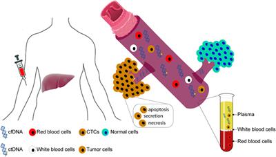 Circulating Cell-Free DNA in Hepatocellular Carcinoma: Current Insights and Outlook